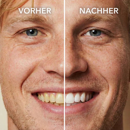 Viralaluna™ Tooth Polish