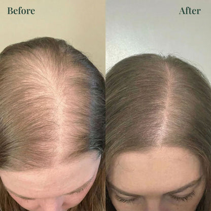 Viralaluna™ Growth-Support Shampoo - 2-Pack