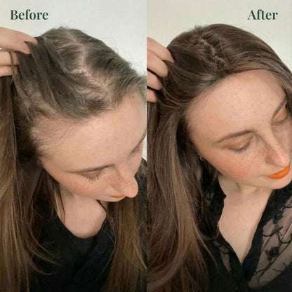 Viralaluna™ Growth-Support Shampoo - 2-Pack