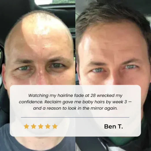 Advanced Hair Growth Roll-On Serum